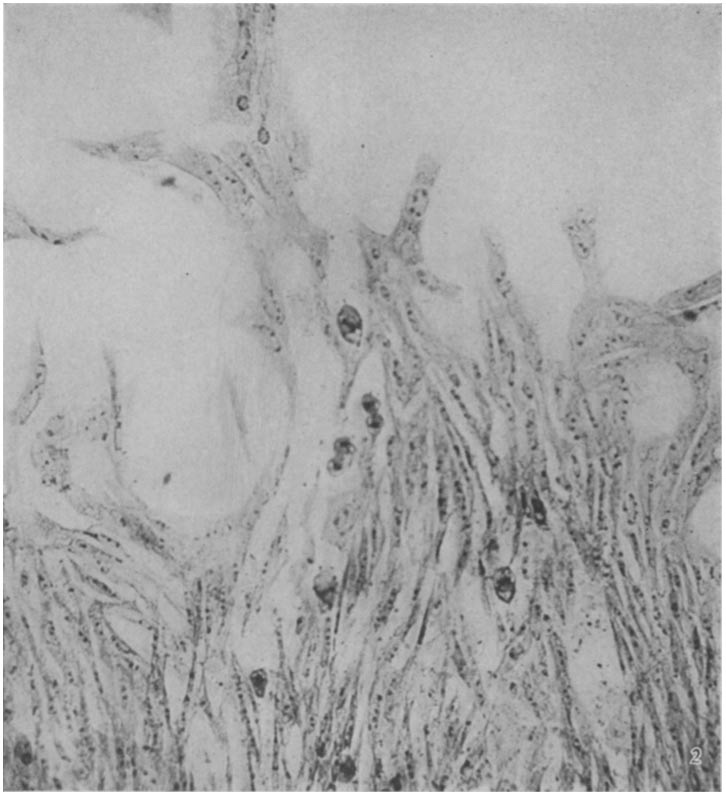 A photomicrograph of long spindle-shaped cells with dark nuclei, some of them in the act of dividing, against a pale background